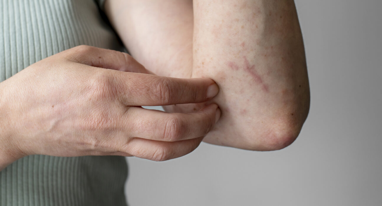 Intervenție de urgență la un colegiu național din Sibiu: Zeci de elevi au acuzat mâncărimi de piele