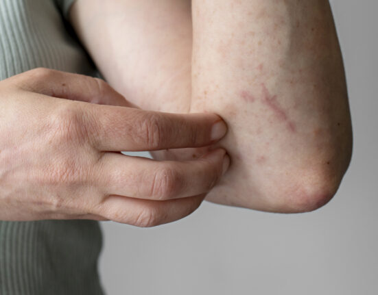 Intervenție de urgență la un colegiu național din Sibiu: Zeci de elevi au acuzat mâncărimi de piele