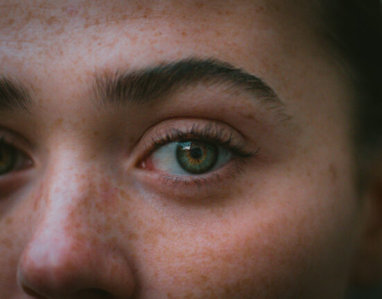 Poți scăpa de petele întunecate de pe ten