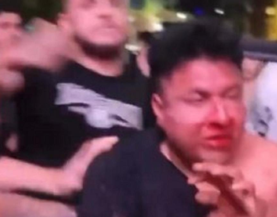 Şoferul care a rănit 30 de oameni în Los Angeles a acţionat cu intenţie