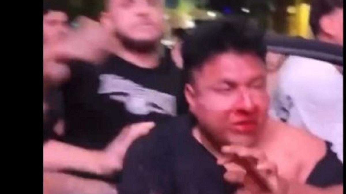 Şoferul care a rănit 30 de oameni în Los Angeles a acţionat cu intenţie