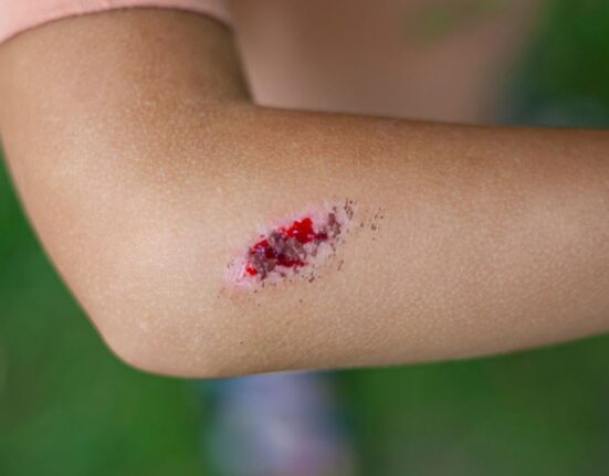 Boala infecțioasă gravă, cu mortalitate ridicată dacă nu este tratată rapid și corect. Sporii care o cauzează pot supraviețui ani de zile