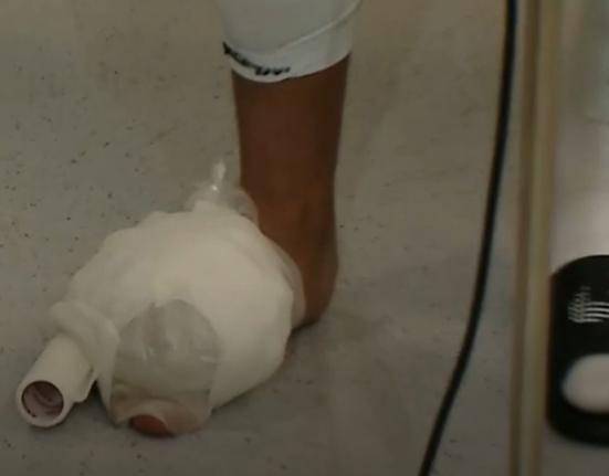 Imagini horror cu piciorul lui Mihai Lixandru. Cum a venit fotbalistul la flash-interviu