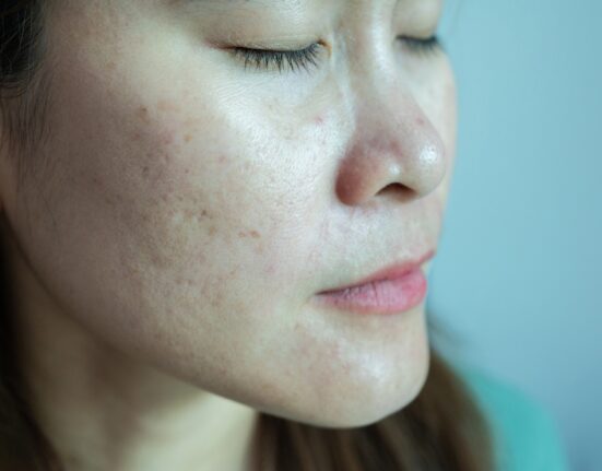 „Rutina de îngrijire trebuie să fie cât mai puțin complicată. Nu vă lăsați furați de mirajul din social-media”. Sfaturi aplicate de la dermatolog
