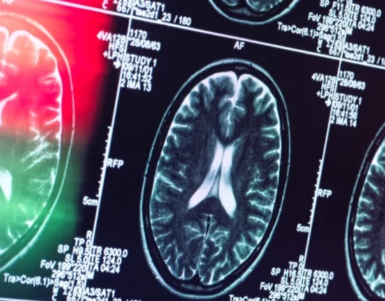 Institutul de Psihiatrie ‘Socola’ introduce un tratament unic în România pentru Alzheimer